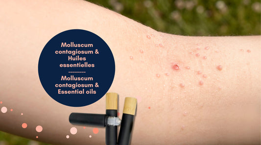 Aborder le molluscum contagiosum de manière naturelle avec les huiles essentielles